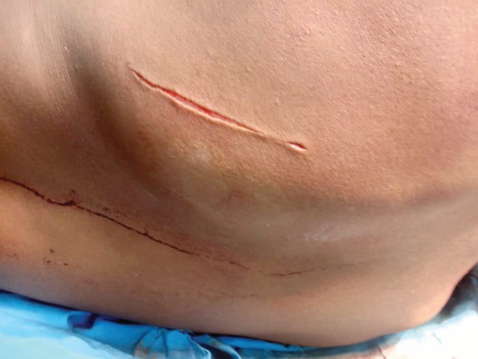 Teenager stabbed with knives, condition critical