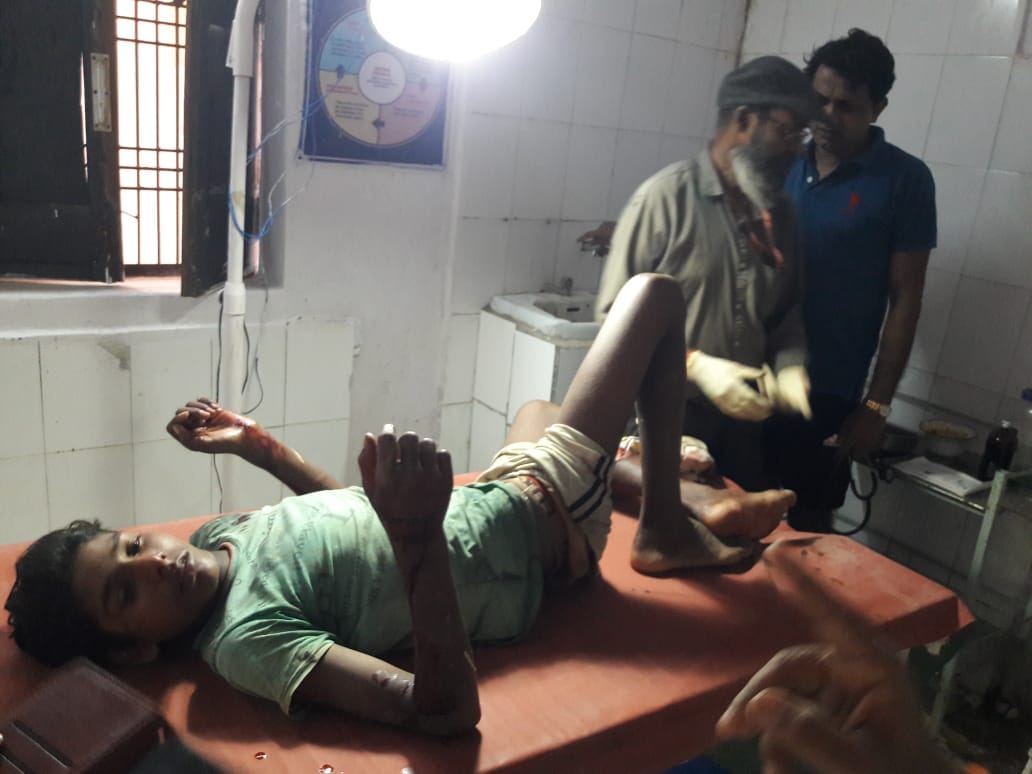 Crocodile attacked the boy who went towards the farm, condition critical