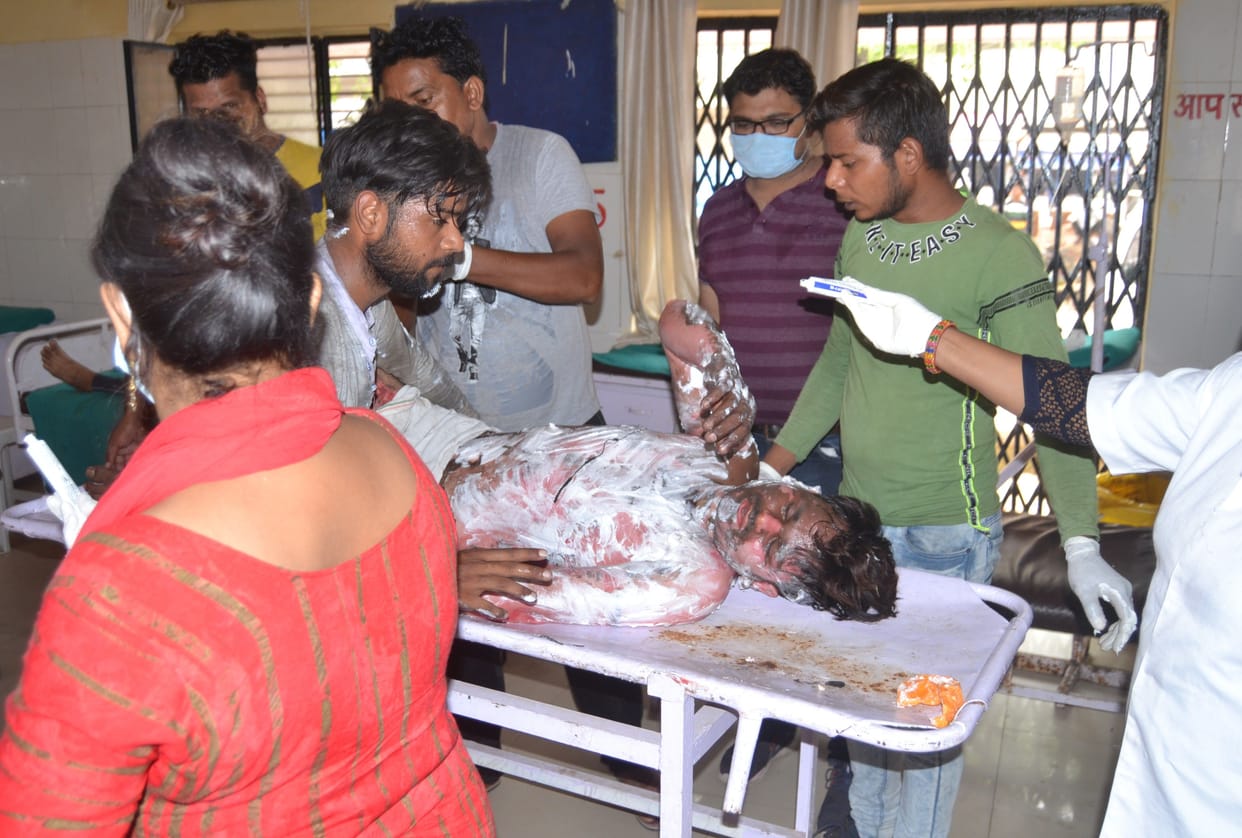Hathras: Contract electrical worker scorched by current while repairing power line