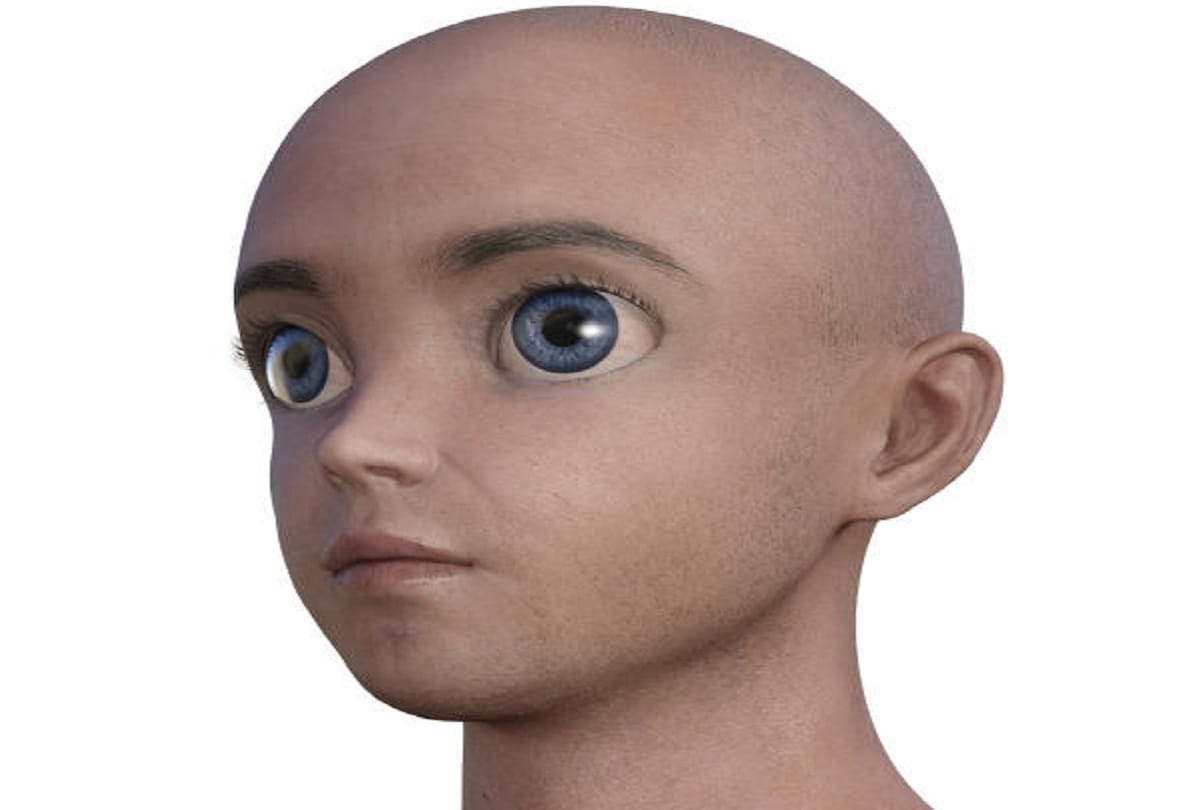 Signs and Symptoms of Progeria Syndrome rare genetic disease that causes children to age rapidly