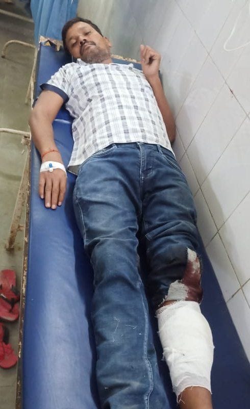 History sheeter miscreant got shot in the leg in police encounter