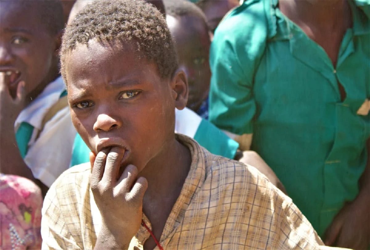 Marburg New Virus WHO says 1st West African Case Detected in Guinea