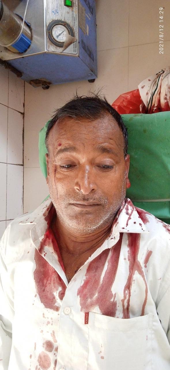 During the panchayat, the father-in-law was injured with an ax on his head.