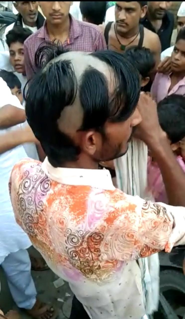 Two youths who came to buy drugs were made bald, video viral
