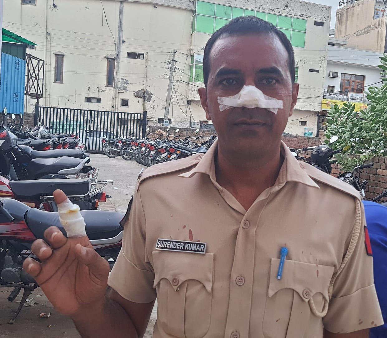 Seven people injured in banned Chinese manjha, one in critical condition
