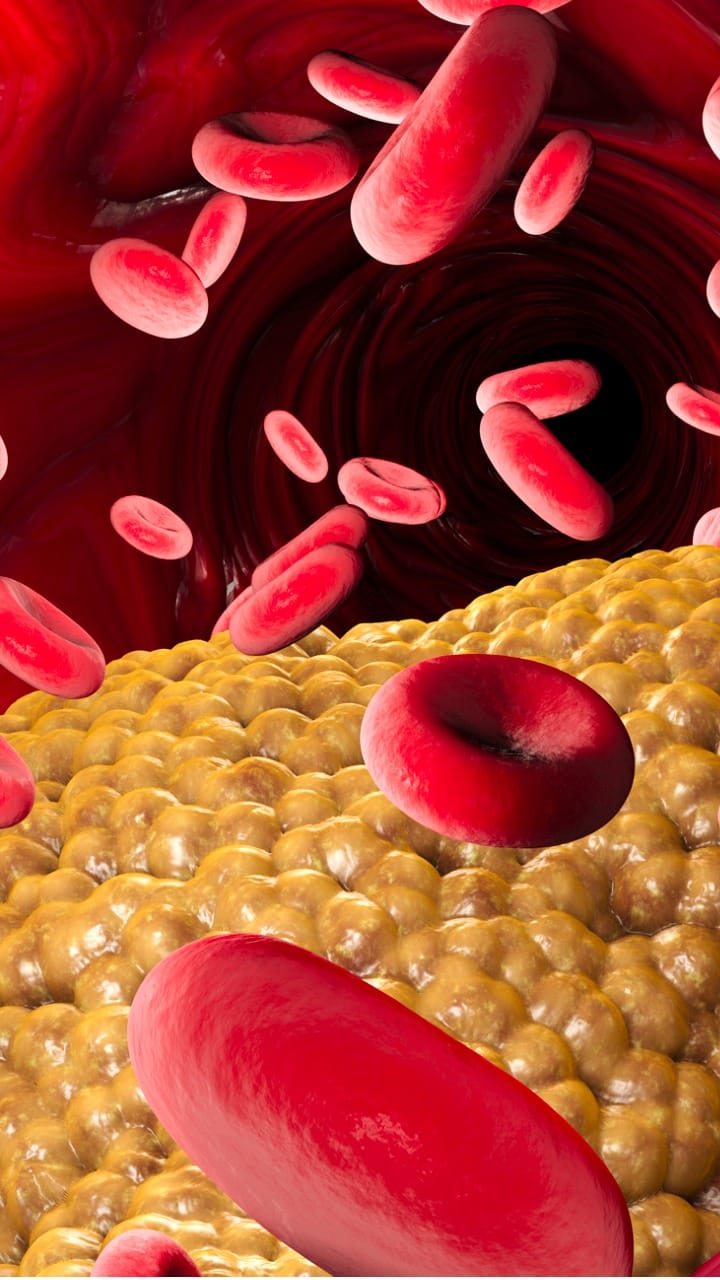 why high triglycerides and cholestrol is bad for heart health know best way to lower triglycerides