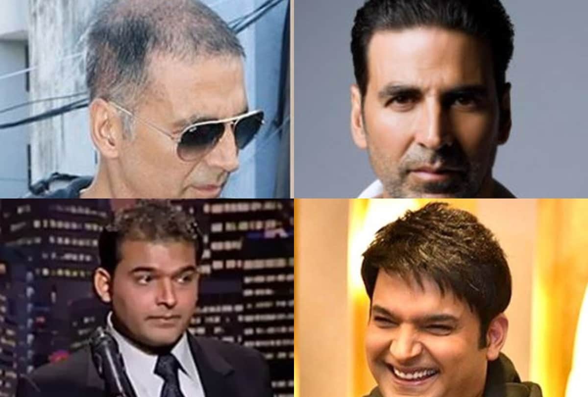 Akshay kumar to kapil sharma these actors were almost bald in real life now uses wig or hair transplant