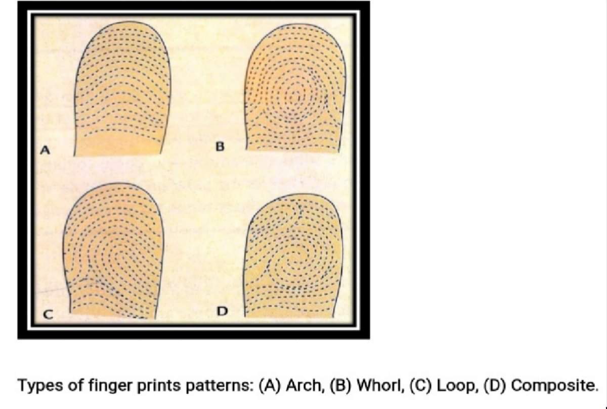 Breast cancer detection by hand lines