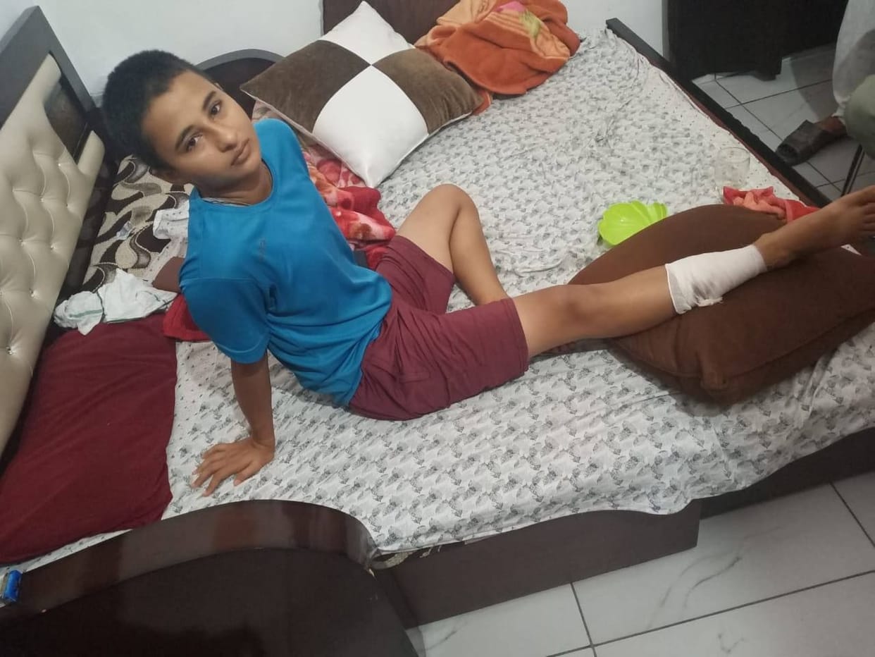 Wrestling player was bitten by monkeys, 12 players have been bitten earlier