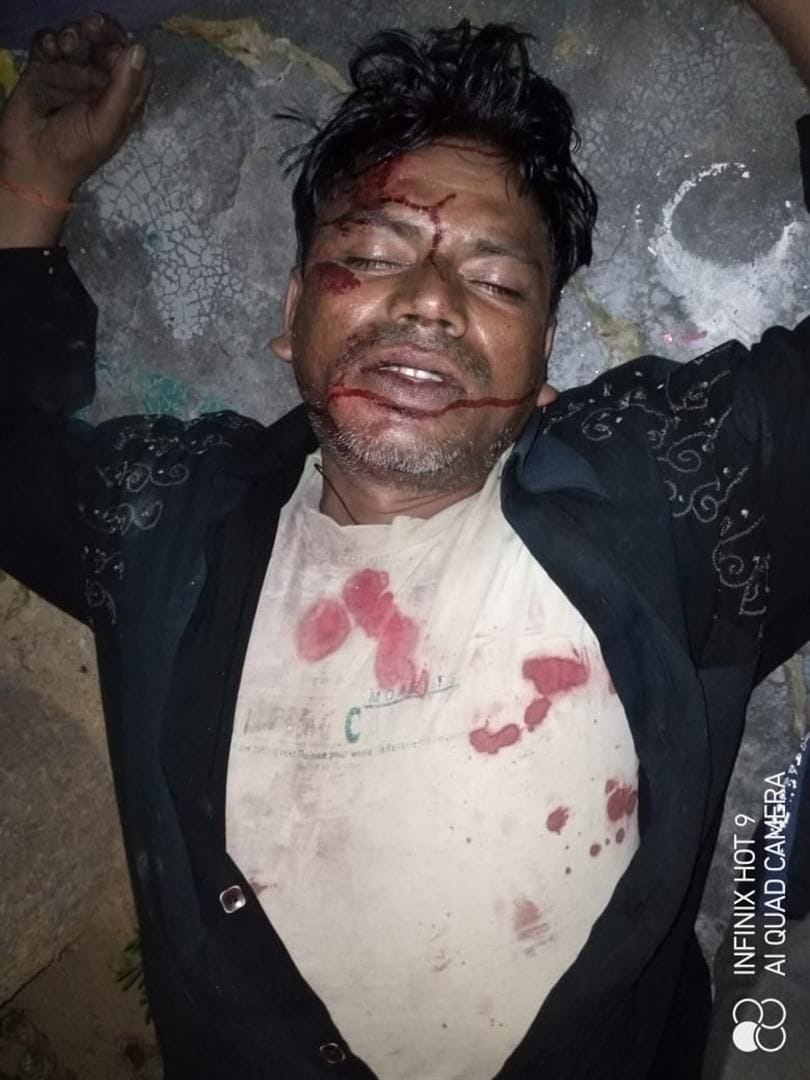 Hathras: People from two villages clashed for refusing to exercise on the road, five injured
