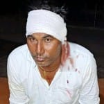 घायल शशि।