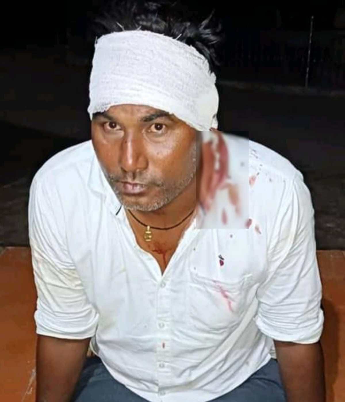 Beer shop Salesman shot in varanasi absconding while firing in varanasi