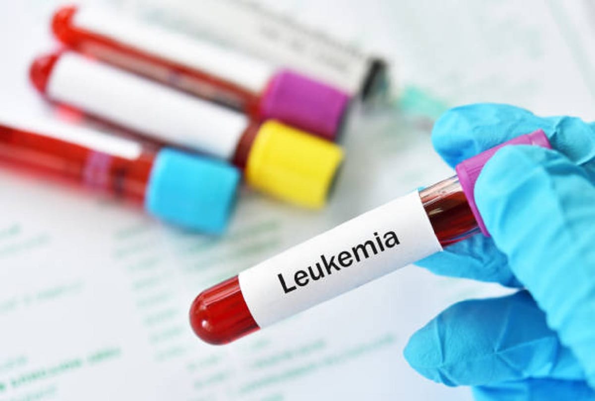 causes and risk factors of childhood cancer know Pediatric cancers prevention tips