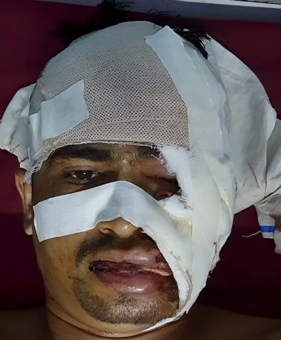 Bike collided with pillar, ITBP jawan injured