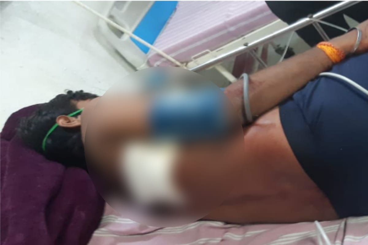 Meerut: Six miscreants fired on a youth in Mawana in boad daylight
