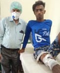नानकमत्ता सीएचसी में भर्ती भालू के हमले से घायल तनुज सिंह राणा।
