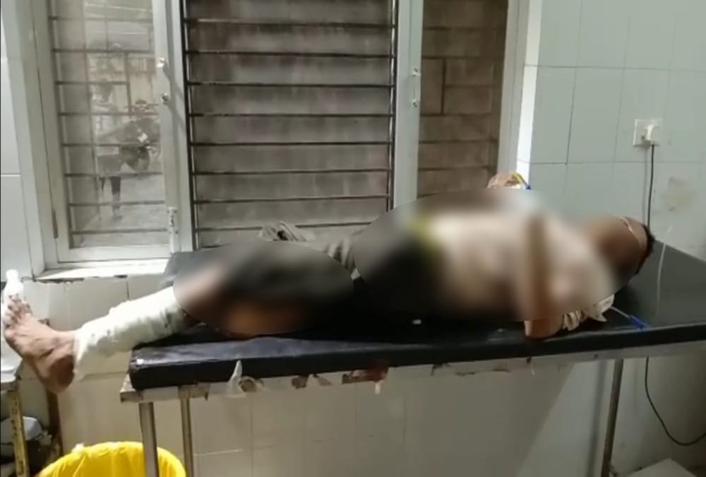 Uttarakhand News: Tiger attack on forest workers during patrolling in Kalagarh Tiger Forest Division