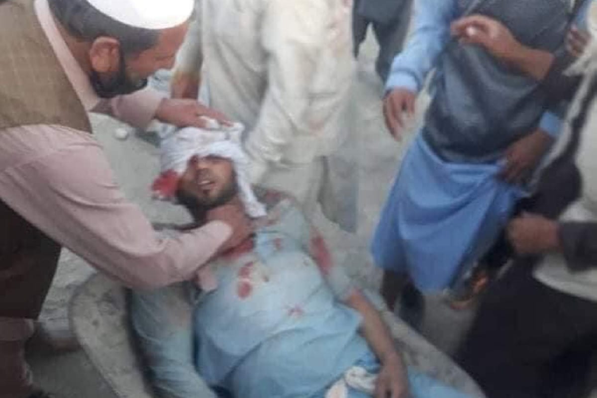 Kabul Airport Explosion leaving people dead and injured in Afghanistan pictures images