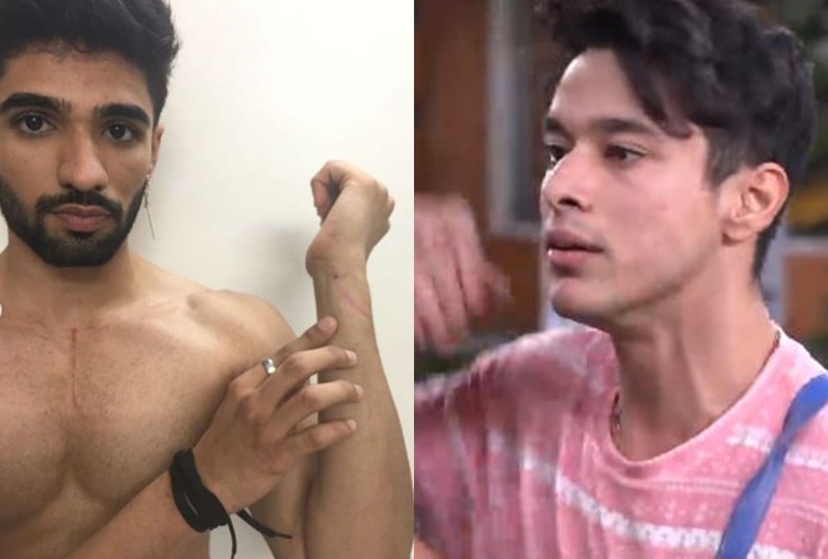 Bigg boss ott  after eviction zeeshan khan share injury photo after fighting with pratik sahejpal users demand justice