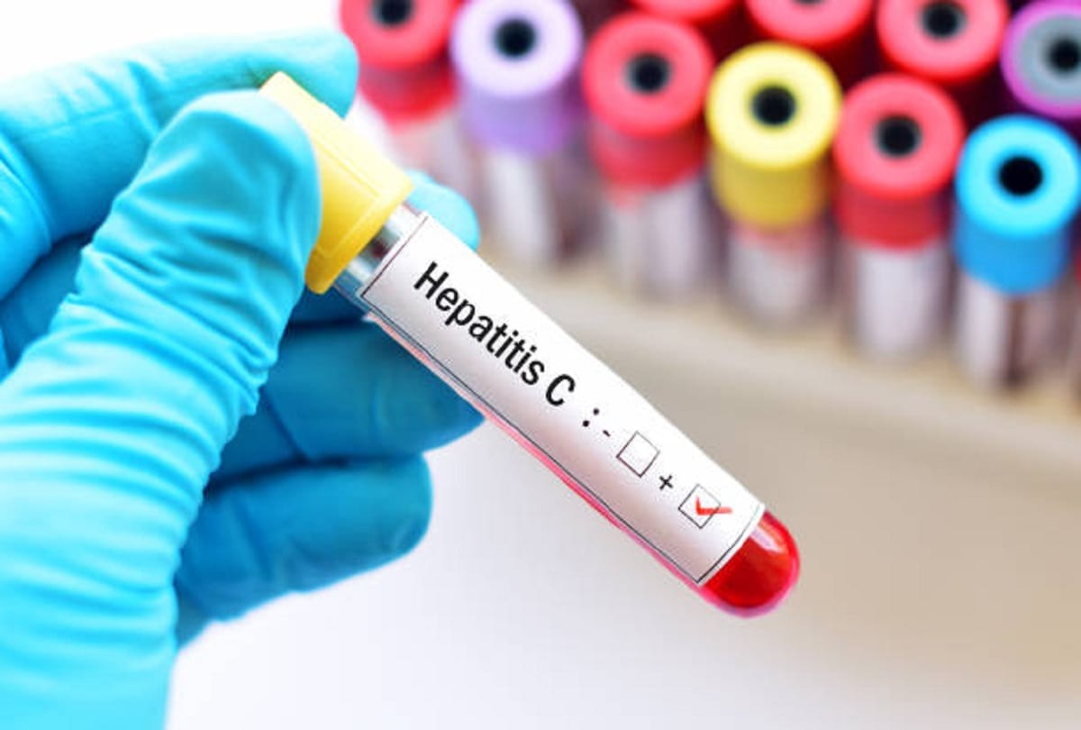 Liver disease Hepatitis C Symptoms test and treatments in hindi