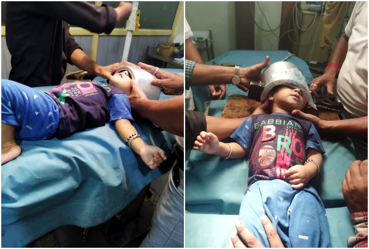 childs head stuck pressure cooker doctor saved life