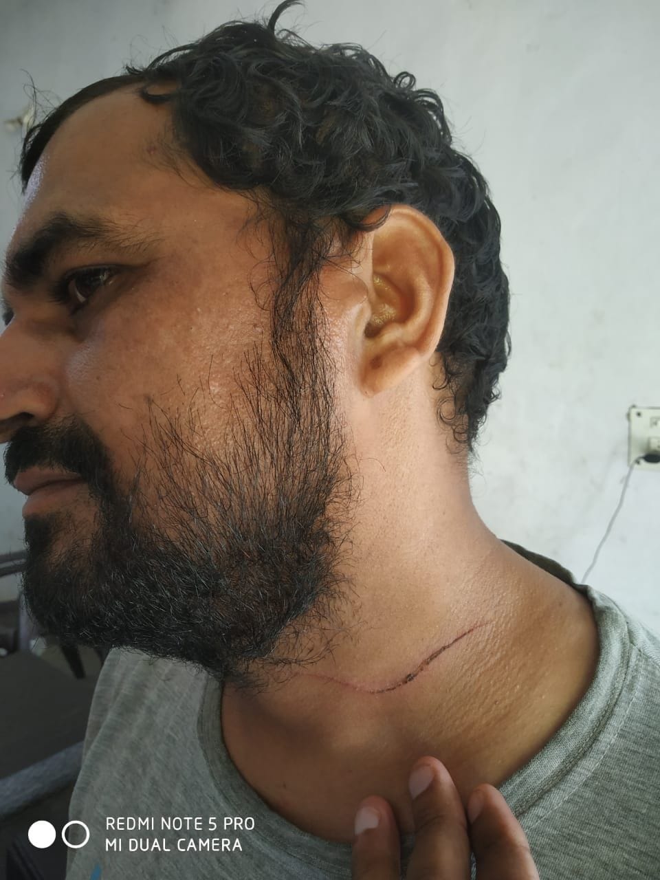accident