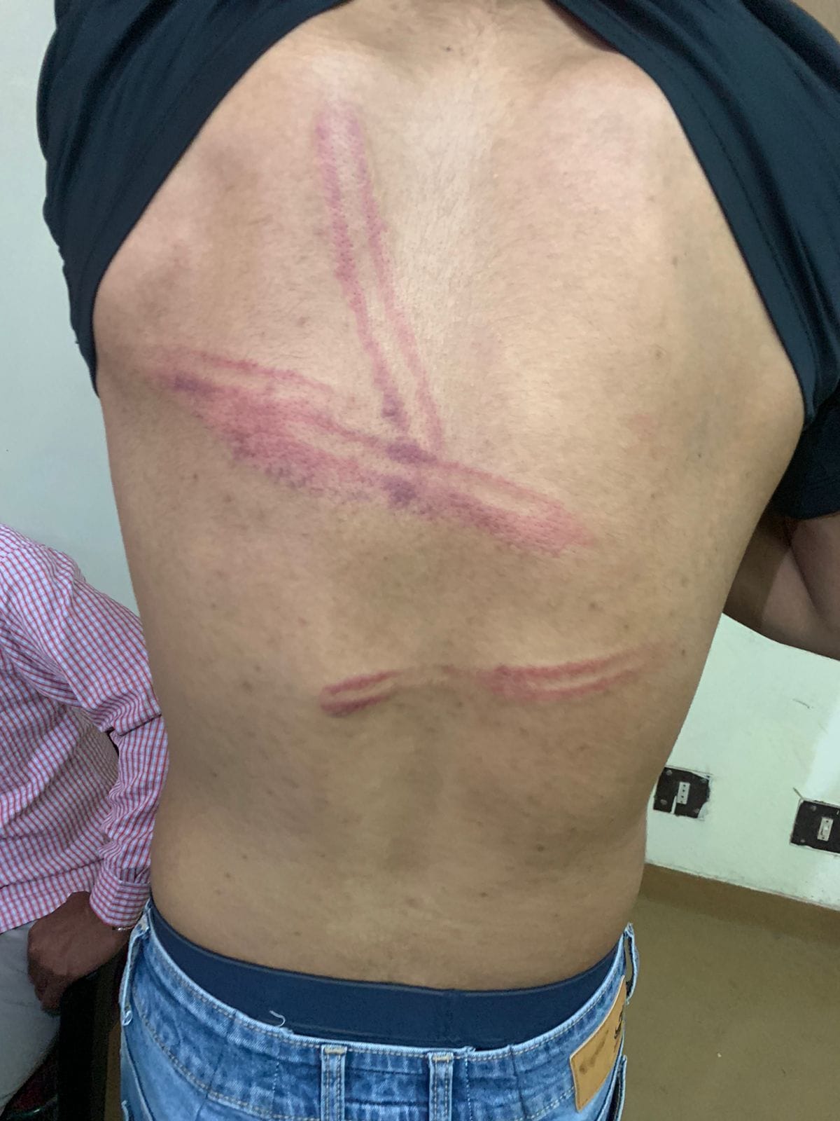 15 youths attacked the showroom operator in broad daylight, the woman closed the shutter, two arrested