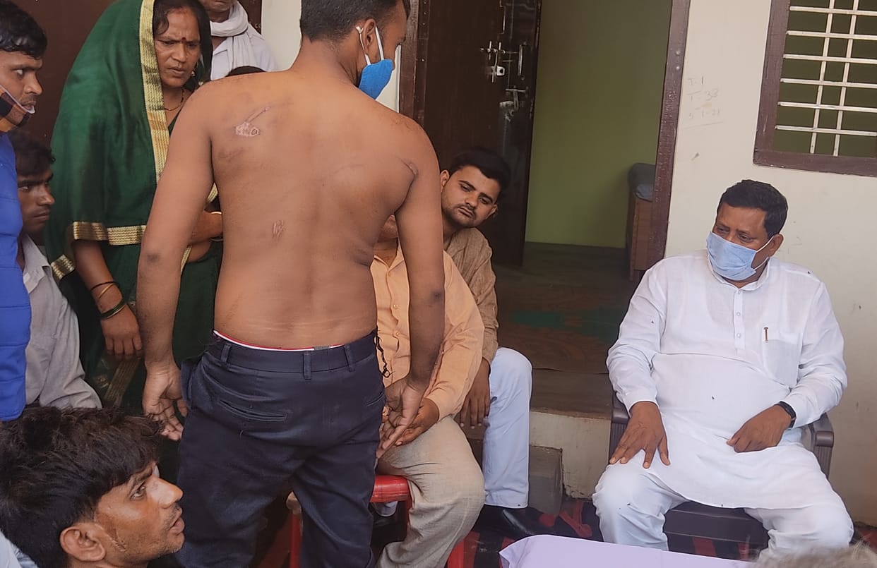 etawah news,MP reached Patel Nagar, heard agony