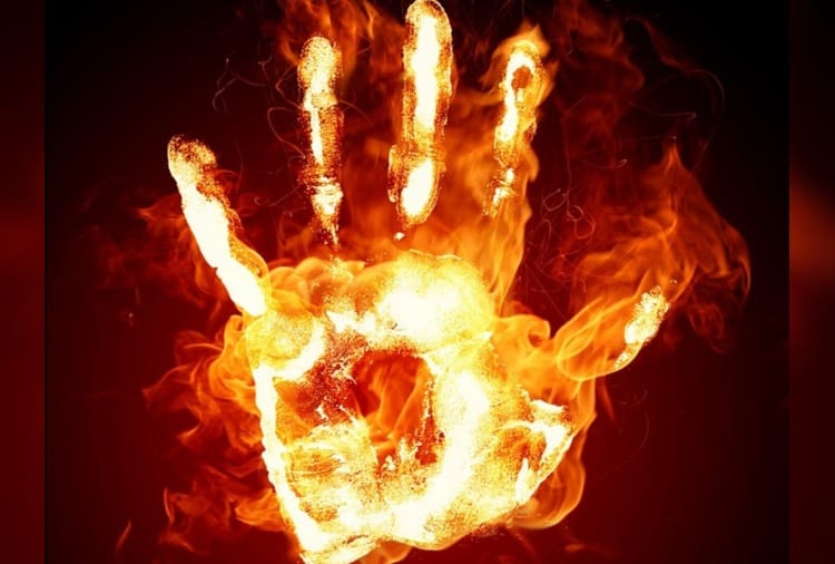 Young woman living in a live-in-relationship was set ablaze by her lover in Sonipat