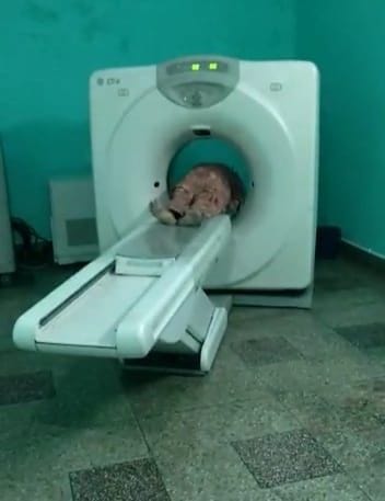 CT scan report being made from bad machine