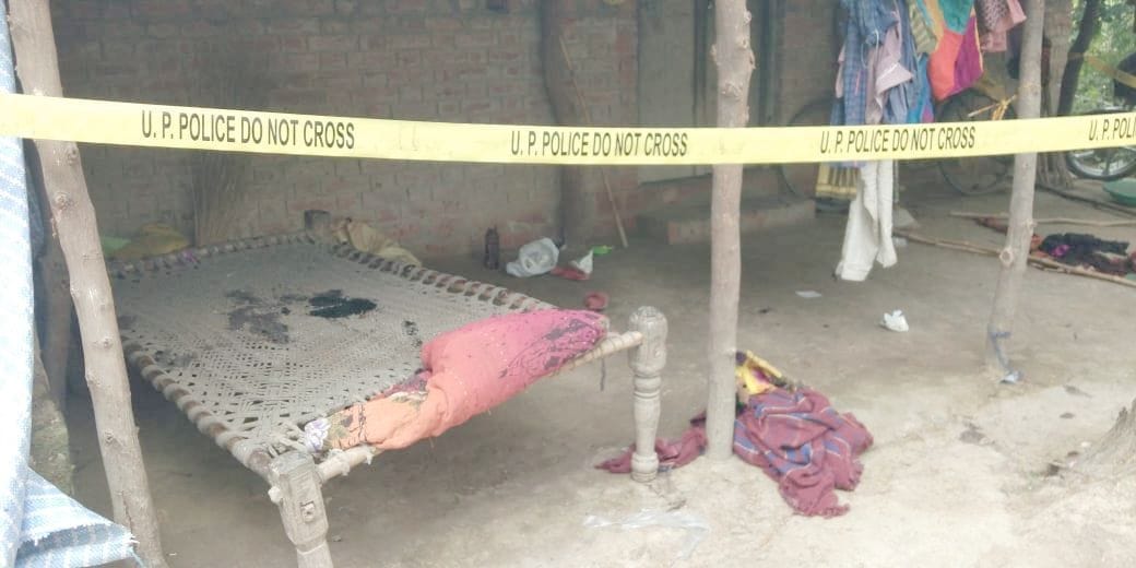 girlfriend and her brother were attacked with acid