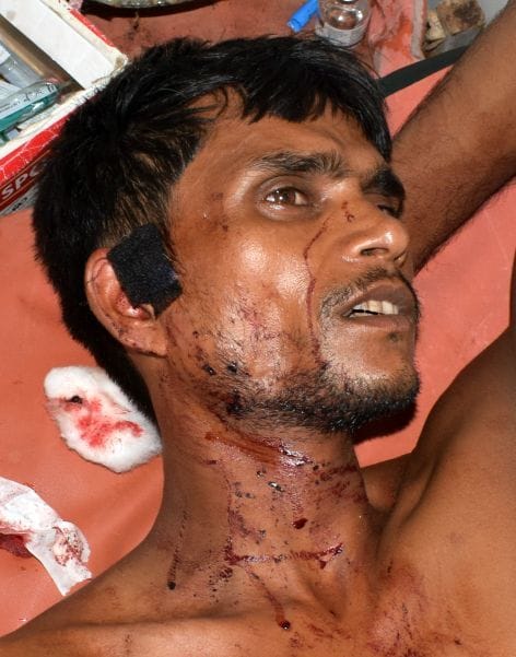 crime,hardoi,hardoi news,gunshot
