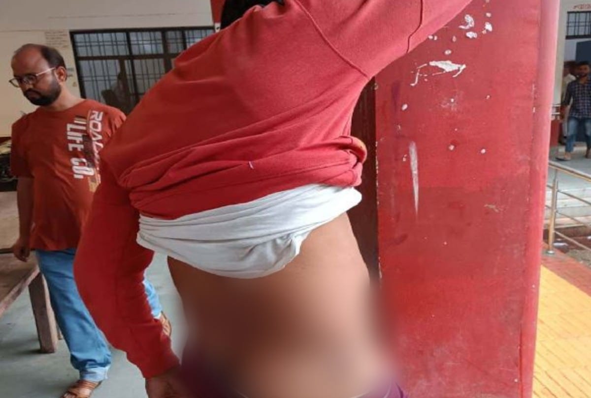 agra news young man alleges police beating him in agra