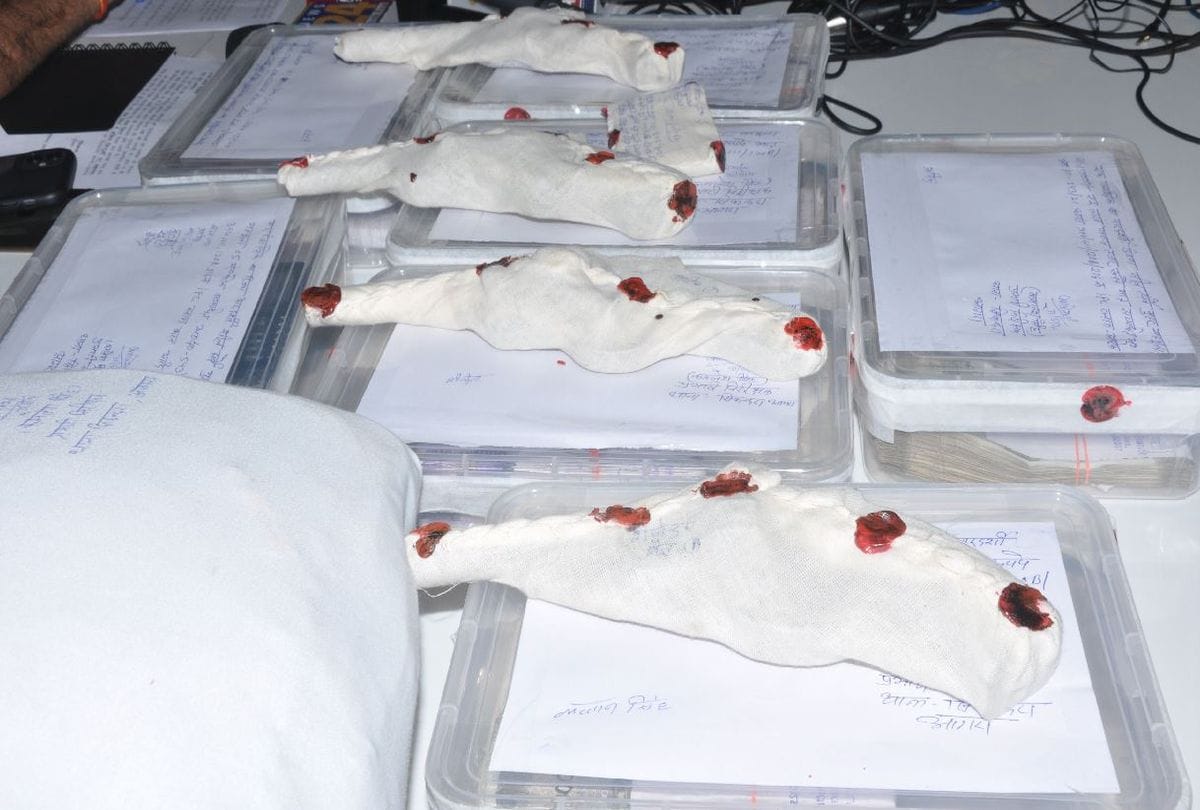 Agra Police Arrests Miscreant Who Looted 11 Lakh Rupees Cash Of Petrol Pump
