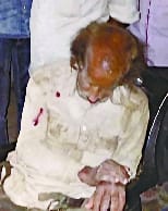 Elderly's treatment started, son's challan for breach of peace