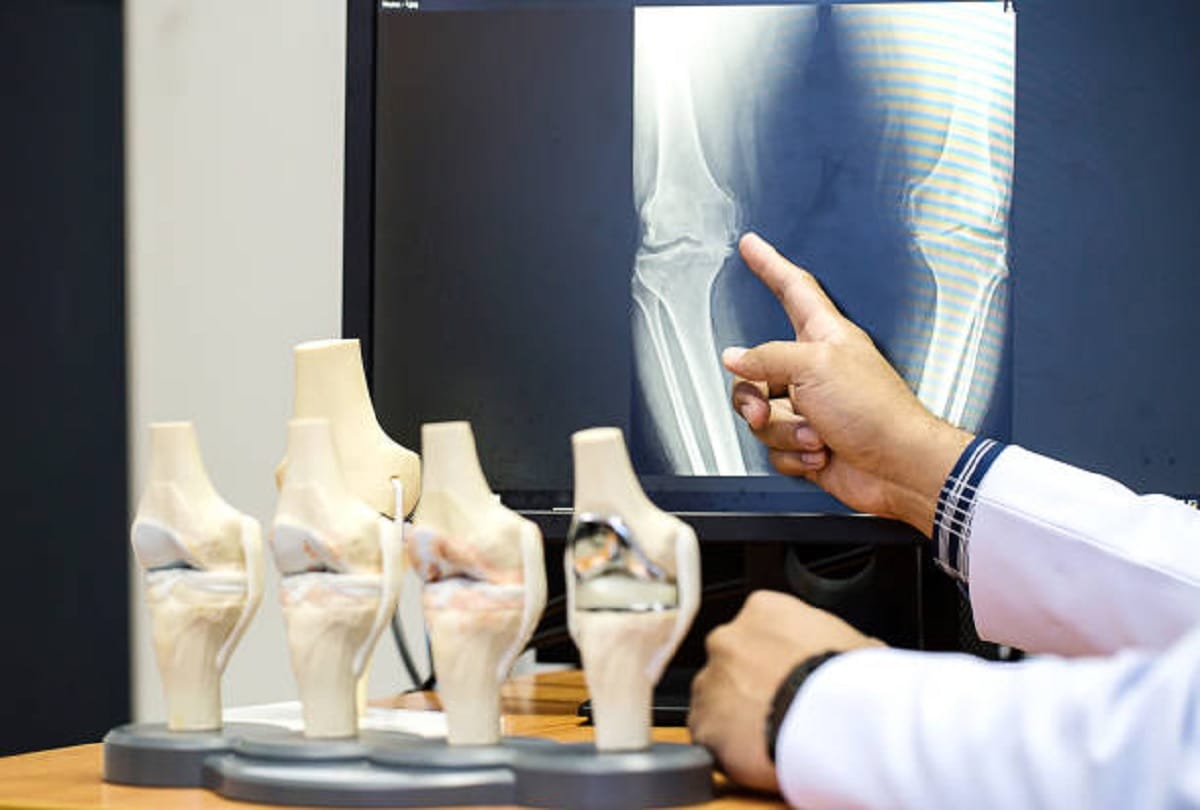 World Osteoporosis Day weakening bones due to changing lifestyle daily sunlight and walking benefit