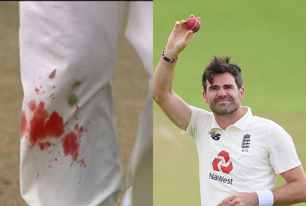 ENG vs IND: Blood from James Anderson pant, but he is still bowling on