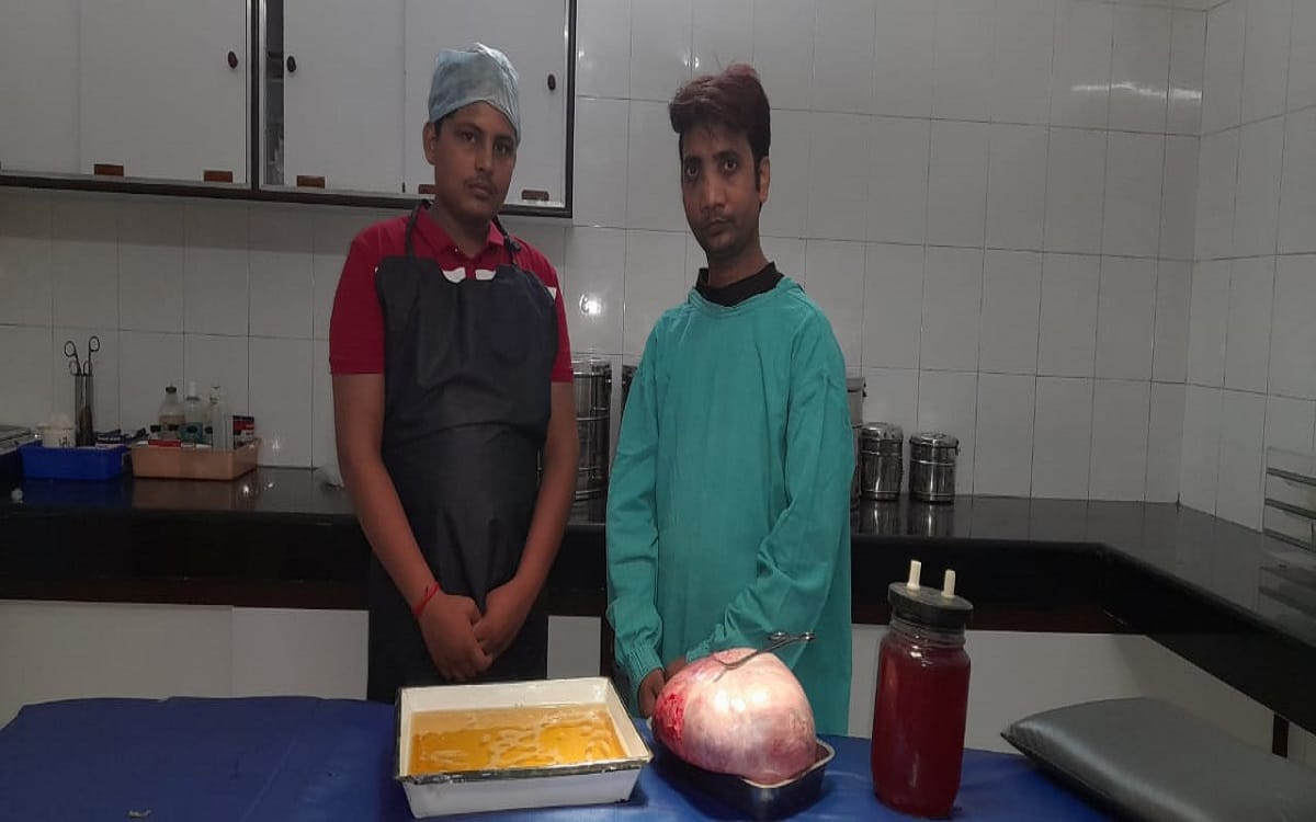 Nine kg tumor removed from womans stomach in varanasi doctors saved her life by complex surgery