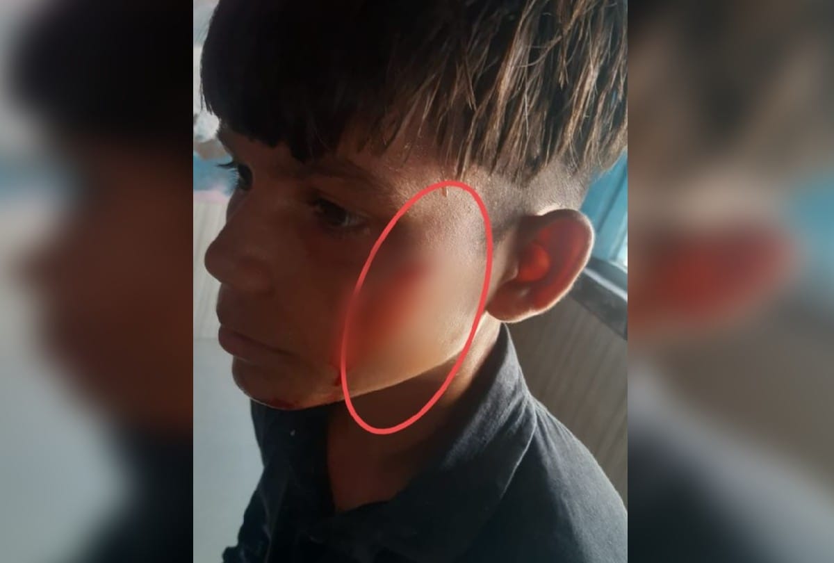 teacher brutally beat up the student in mathura