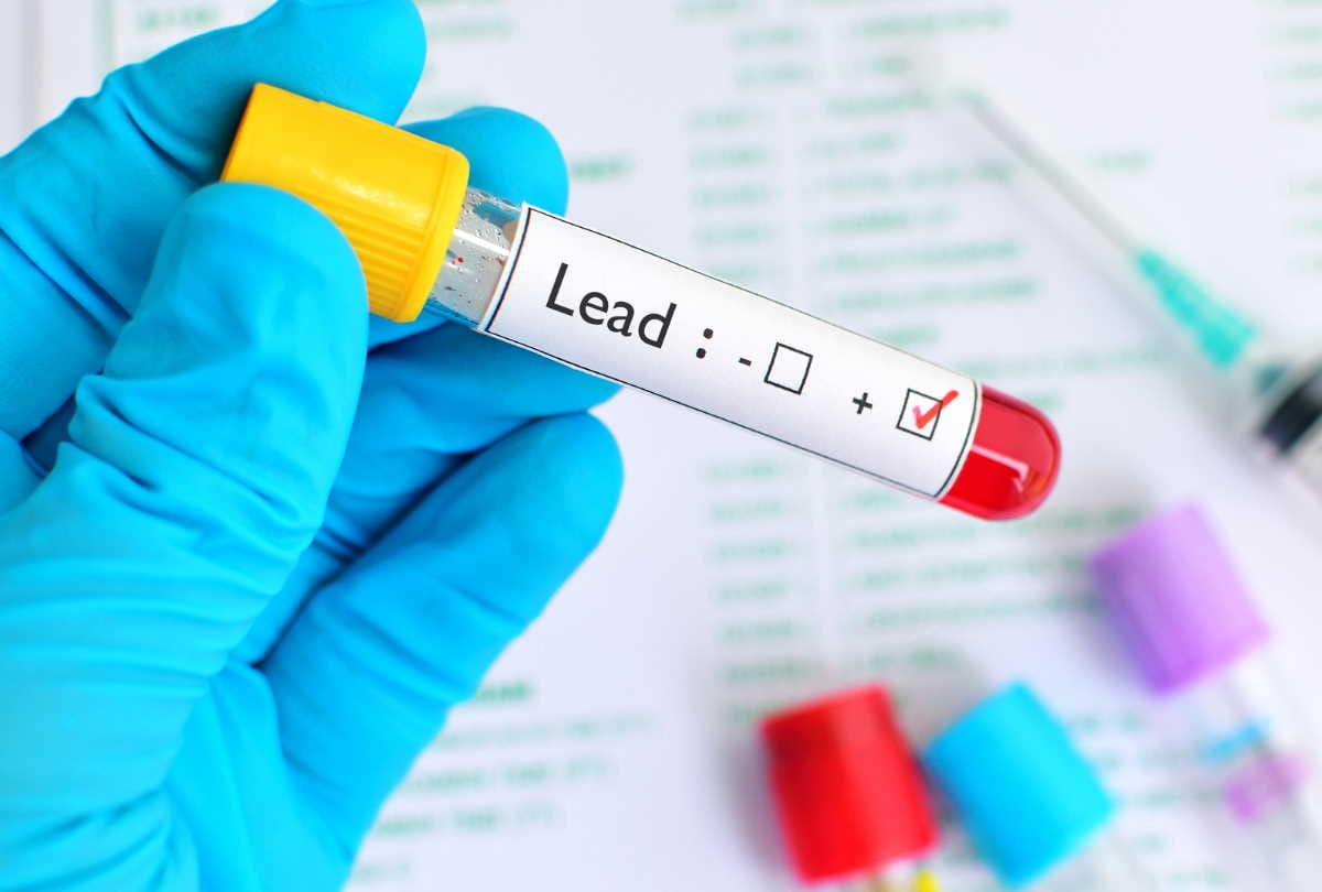 lead poisoning causes and effects, lead toxicity in children