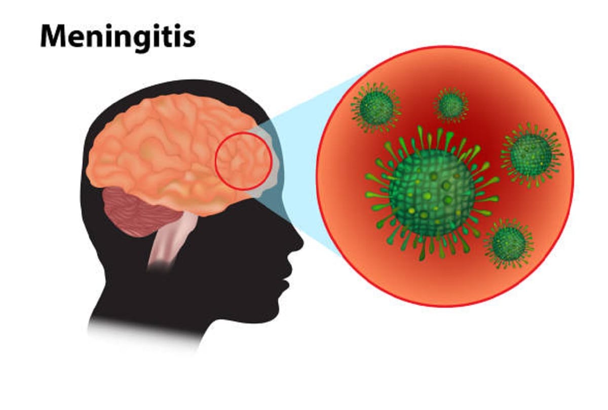 Nipah virus in kerala know the symptoms and prevention tips in hindi