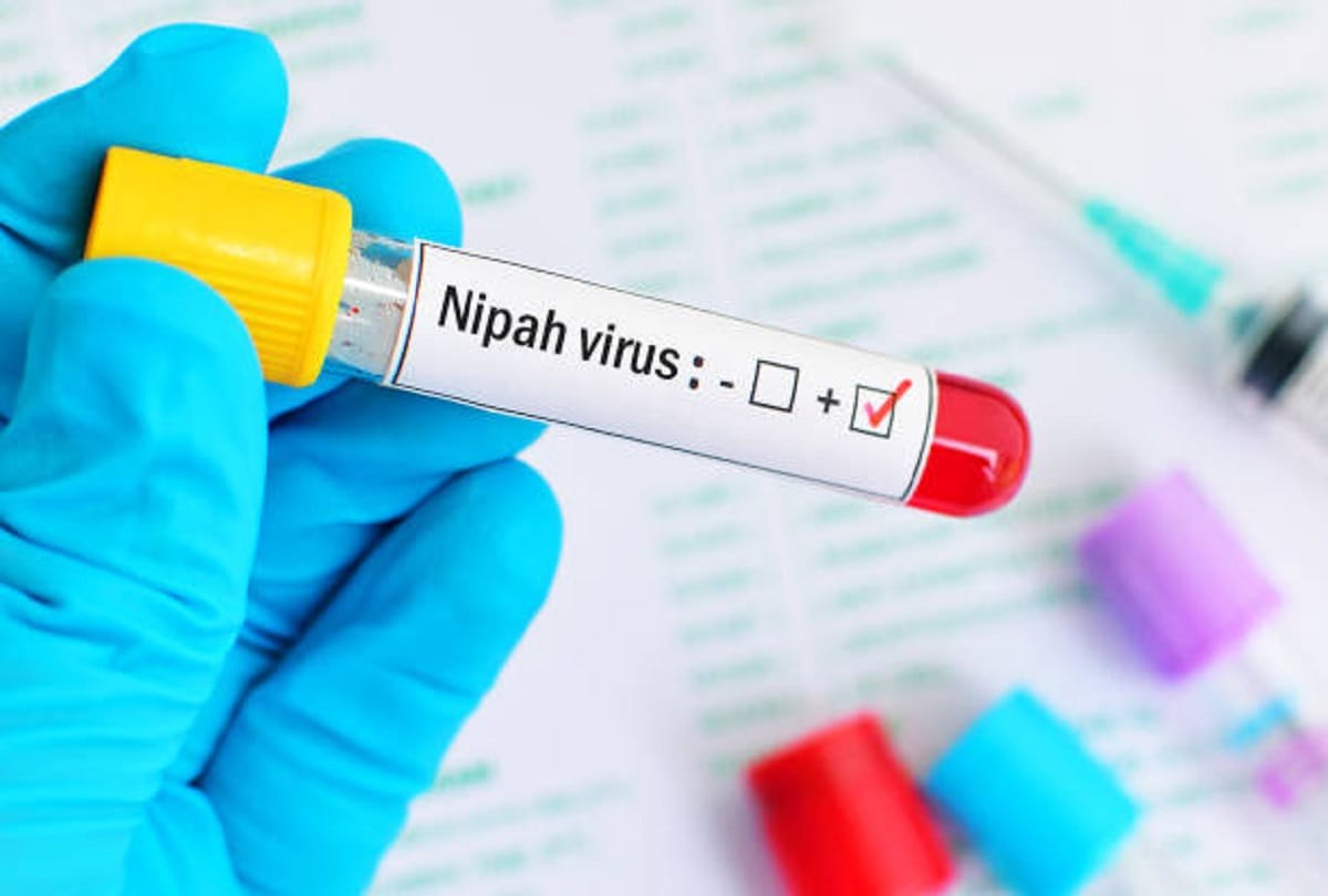 Surveillance will increase to deal with threats like Nipah