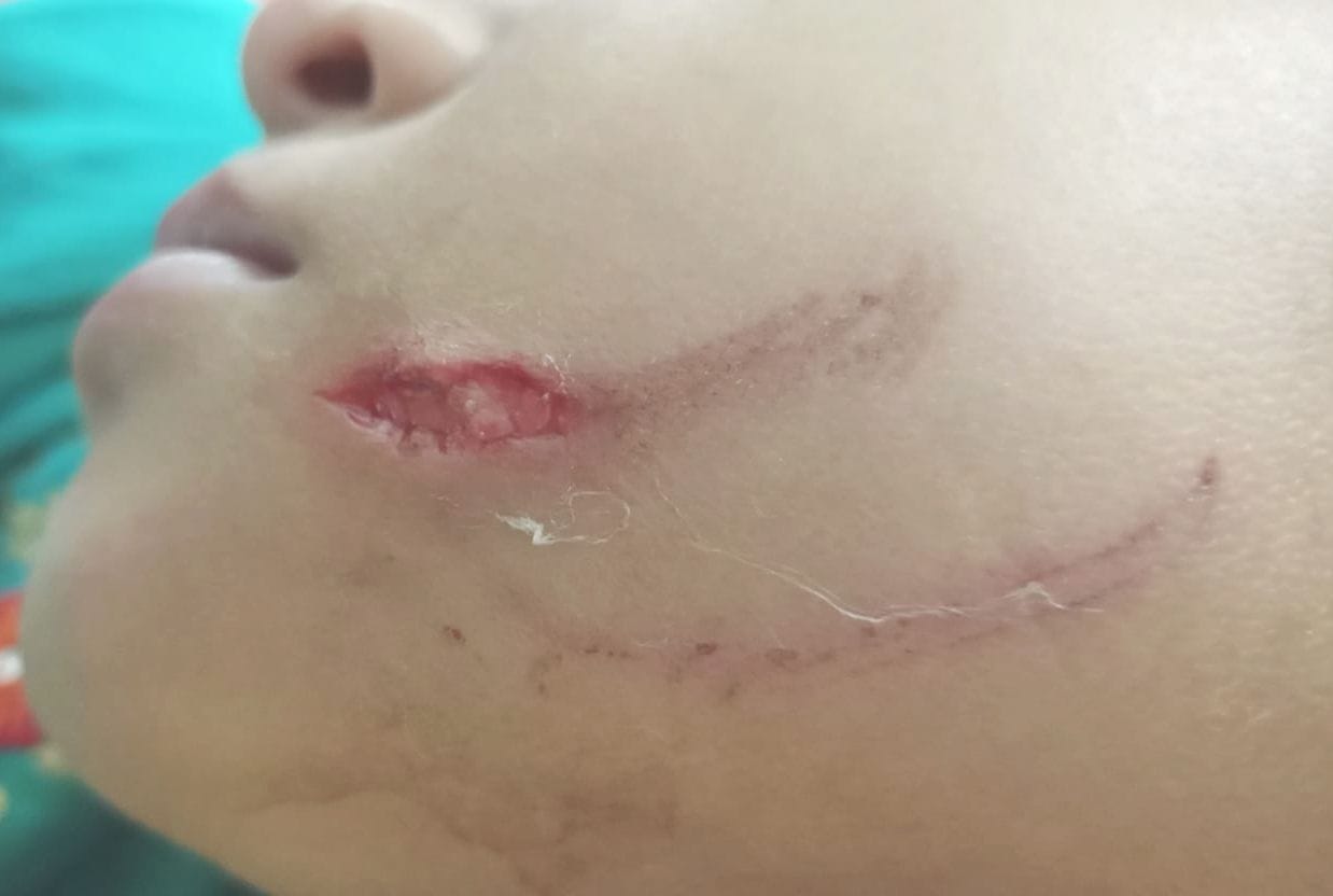 Dogs bitten the face of the girl playing in the society