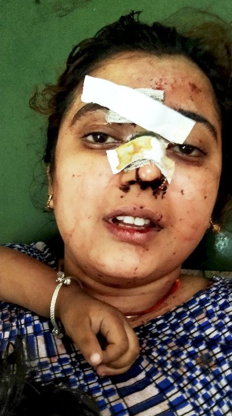 Road accident