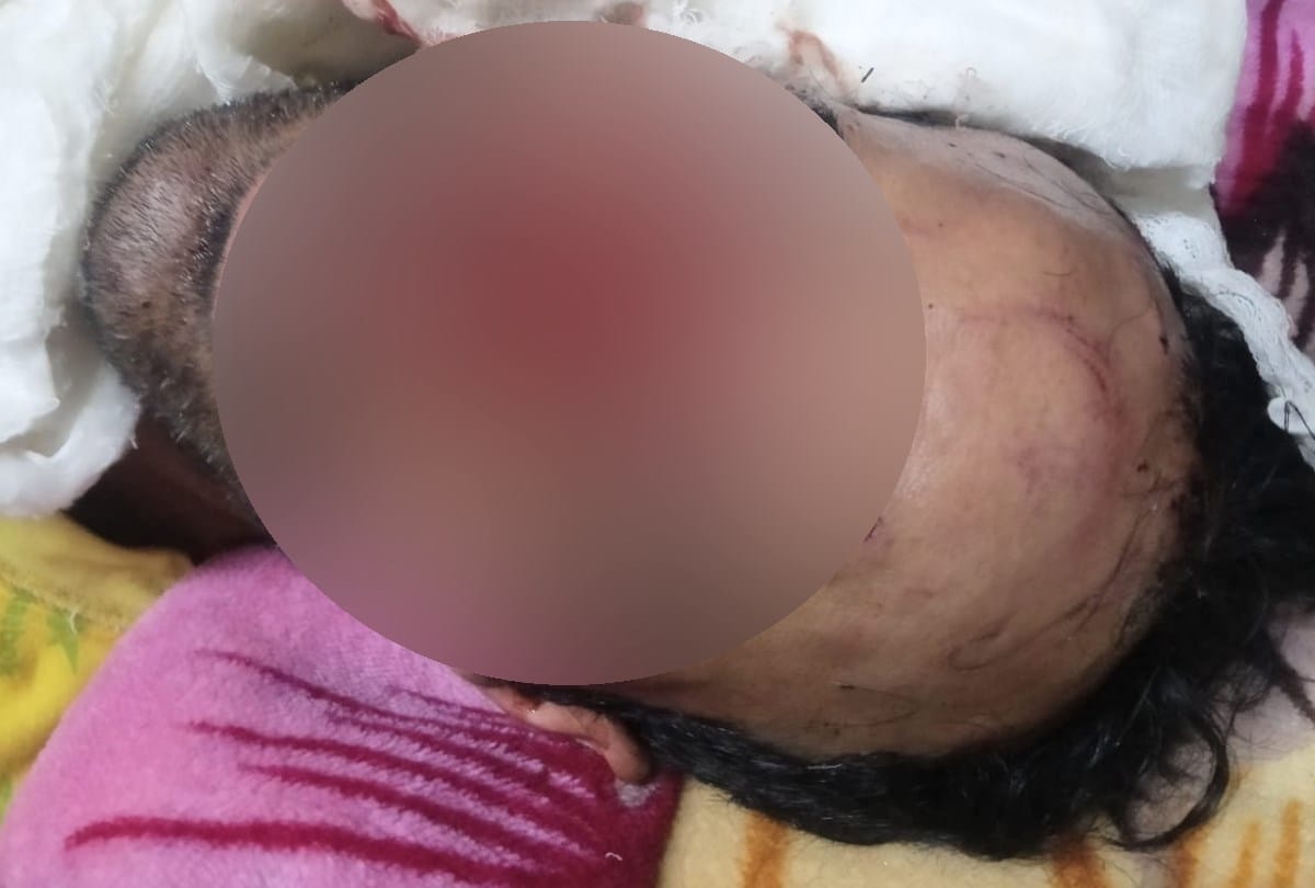 Two injured in bear attack Nerwa Rohru shimla himachal pradesh