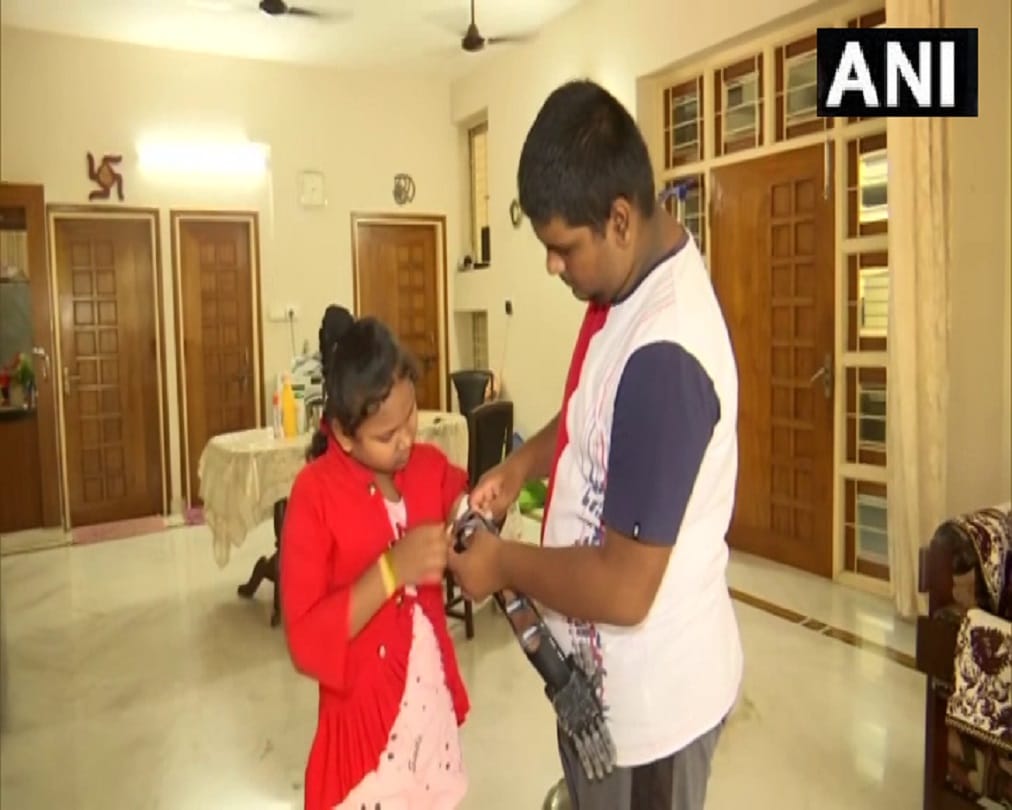 Odisha: Class 11th student made low cost prosthetic hand for differently abled people in Bhubaneswar