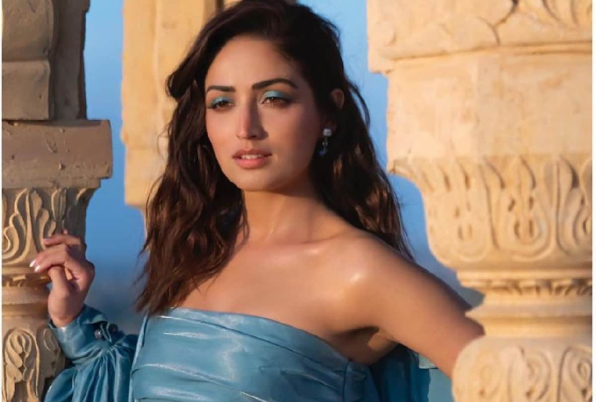 Yami Gautam opens up about her skin disease on Instagram