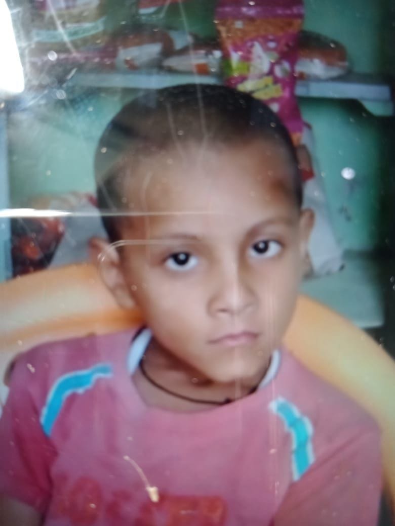Hathras: Innocent dies due to tonga