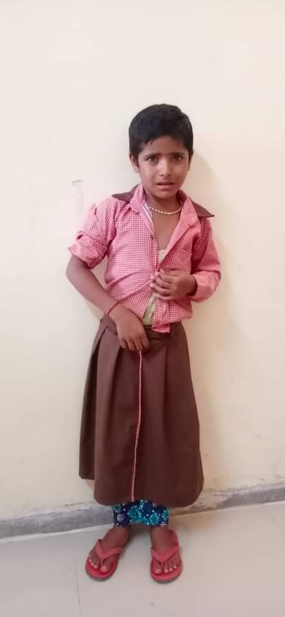 बंदर के हमले से घायल बच्चे।