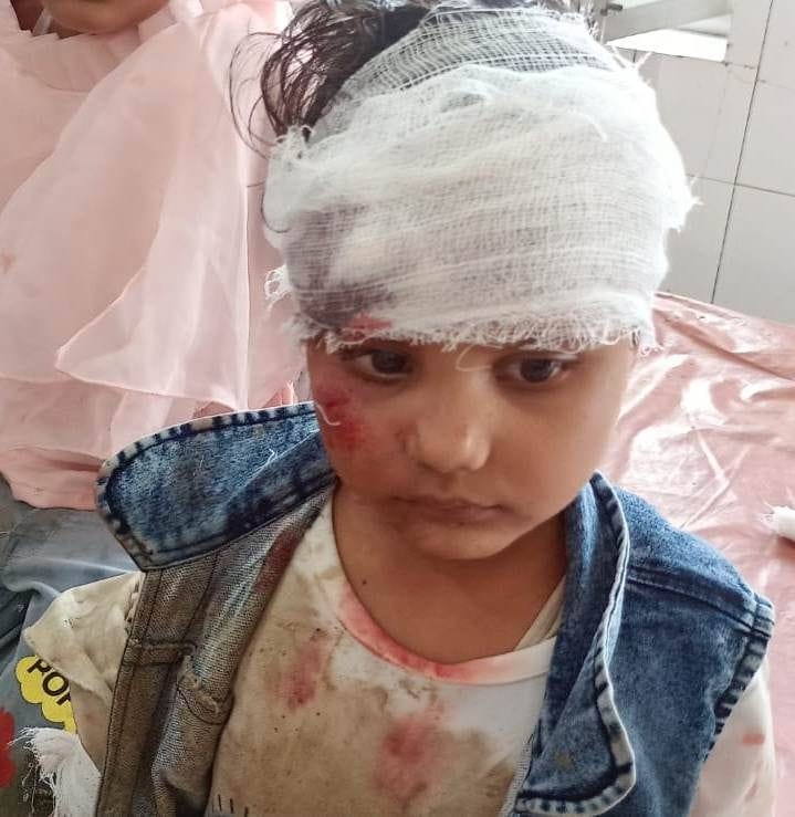 Hathras: Bike slipped due to imbalance, four injured including two girls